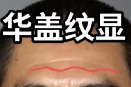 抬头纹与命运:如何改变未来的暗藏玄机